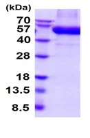 SDS-PAGE - Recombinant Human DDR2 protein (AB222446)