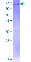 SDS-PAGE - Recombinant Human DDX11 protein (GST tag N-Terminus) (AB158272)