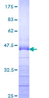 Recombinant Human DDX54 protein