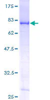 SDS-PAGE - Recombinant Human DDX6 protein (GST tag N-Terminus) (AB114574)