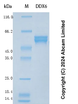SDS-PAGE - Recombinant Human DDX6 Protein Standard (His tag) (AB323164)
