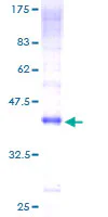 SDS-PAGE - Recombinant Human Dectin-1 protein (GST tag N-Terminus) (AB163849)
