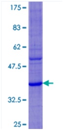 Recombinant Human DEFA6 protein