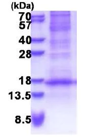 SDS-PAGE - Recombinant Human DEFB116 protein (denatured) (His tag N-Terminus) (AB171484)