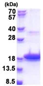 SDS-PAGE - Recombinant Human DEFB118 protein (His tag N-Terminus) (AB174392)