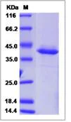 SDS-PAGE - Recombinant Human DEFB127 protein (Fc Chimera) (AB276646)