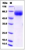 SDS-PAGE - Recombinant Human DEGA protein (His tag) (AB276581)