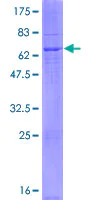 SDS-PAGE - Recombinant Human DEGS2 protein (AB165196)