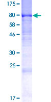 Recombinant Human DENND1A protein