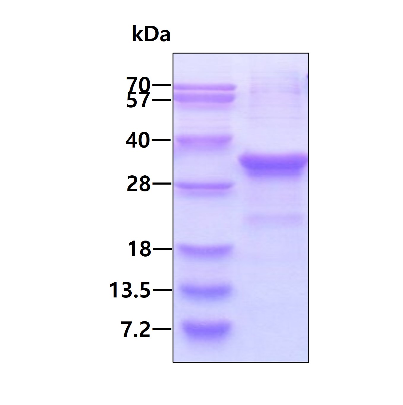 SDS-PAGE - Recombinant Human Density Regulated Protein (His tag N-Terminus) (AB111640)