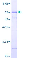 SDS-PAGE - Recombinant Human Deptor protein (AB163883)
