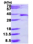 SDS-PAGE - Recombinant Human DERA protein (His tag N-Terminus) (AB113155)
