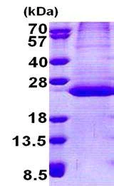 SDS-PAGE - Recombinant Human DeSI-1 protein (His tag N-Terminus) (AB167878)