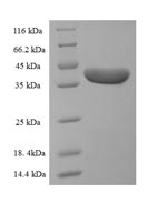 SDS-PAGE - Recombinant Human Desmoplakin protein (His tag) (AB225667)