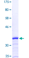 Recombinant Human Desmuslin/SYN protein