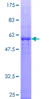 SDS-PAGE - Recombinant Human Dexras1 protein (GST tag N-Terminus) (AB131904)
