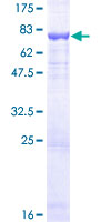 Recombinant Human DFNA5/GSDME protein