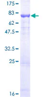 SDS-PAGE - Recombinant Human DFNA5/GSDME protein (AB116824)
