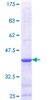 SDS-PAGE - Recombinant Human DGAT2 protein (AB153553), expandable thumbnail