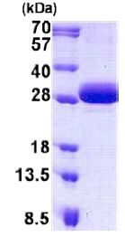 SDS-PAGE - Recombinant Human DGCR6 protein (His tag N-Terminus) (AB140578)