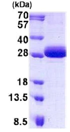 SDS-PAGE - Recombinant Human DGCR6 protein (His tag N-Terminus) (AB140578)
