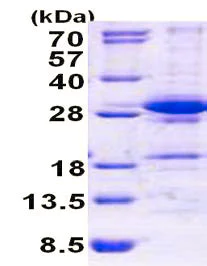 SDS-PAGE - Recombinant Human DGCR6L protein (AB156350)