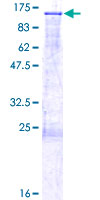 Recombinant Human DGCR8 protein