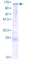 SDS-PAGE - Recombinant Human DGCR8 protein (GST tag N-Terminus) (AB153373)