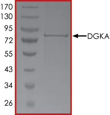 SDS-PAGE - Recombinant human DGKA protein (Active) (AB268441)