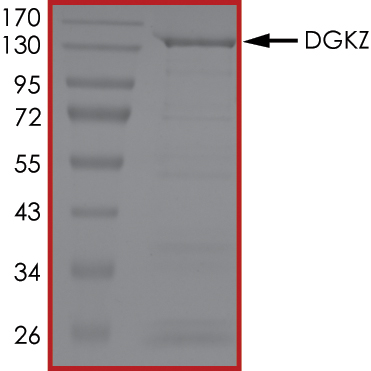 SDS-PAGE - Recombinant human DGKZ/DGK-zeta protein (Active) (AB268445), expandable thumbnail