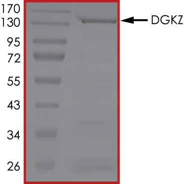 SDS-PAGE - Recombinant human DGKZ/DGK-zeta protein (Active) (AB268445)