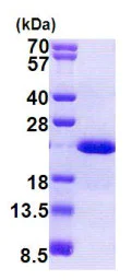 SDS-PAGE - Recombinant Human Dhh protein (AB167833)