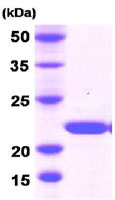 SDS-PAGE - Recombinant Human Dhh protein (AB78682)