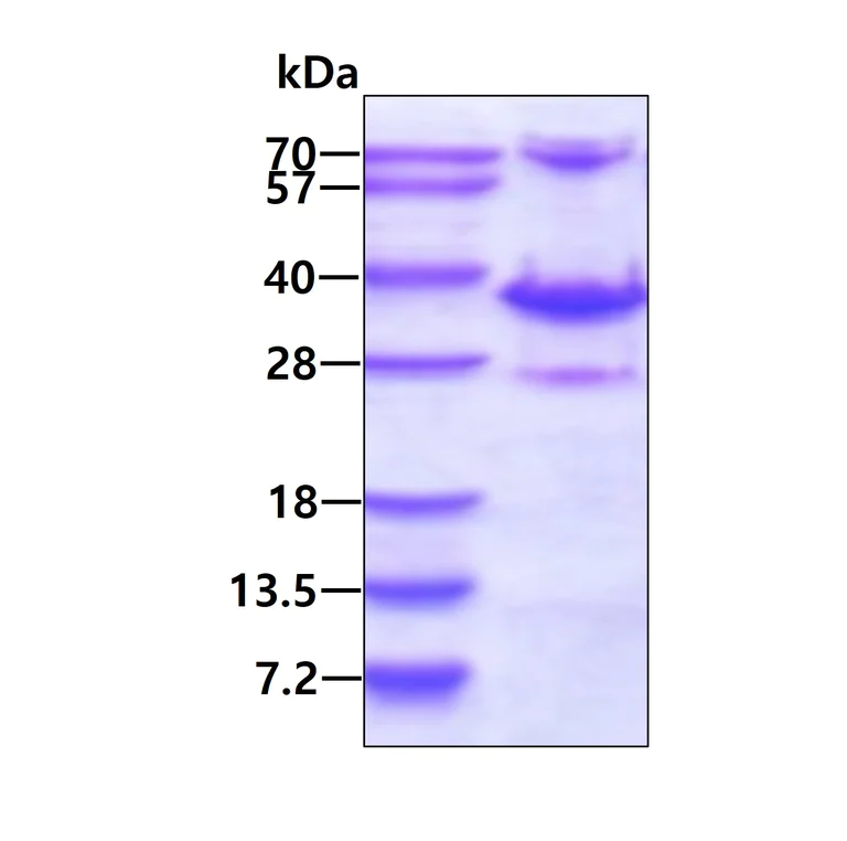 SDS-PAGE - Recombinant Human DHRS4 protein (AB116155)