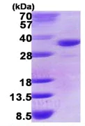 SDS-PAGE - Recombinant Human DHRS9 protein (His tag N-Terminus) (AB123162)
