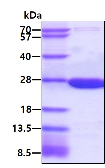 SDS-PAGE - Recombinant human Dihydrofolate reductase (DHFR) protein (His tag N-Terminus) (AB87755)