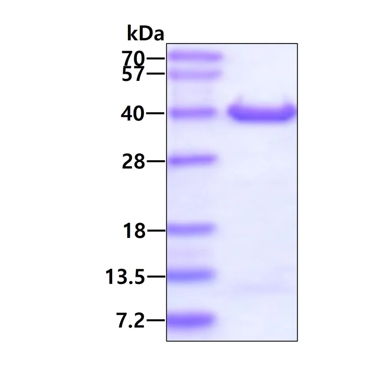SDS-PAGE - Recombinant Human DIMT1L protein (AB130040)