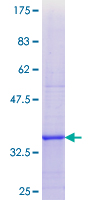 SDS-PAGE - Recombinant Human DIO1 protein (AB158285), expandable thumbnail