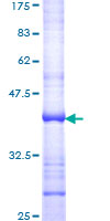 Recombinant Human DIO2 protein