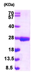 SDS-PAGE - Recombinant Human DIPP protein (His tag N-Terminus) (AB103915)