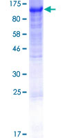 SDS-PAGE - Recombinant Human Dishevelled 2 protein (AB152348), expandable thumbnail