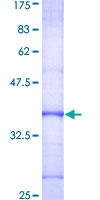 SDS-PAGE - Recombinant Human DKC1/Dyskerin protein (GST tag N-Terminus) (AB152335)