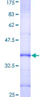 SDS-PAGE - Recombinant Human DKC1/Dyskerin protein (GST tag N-Terminus) (AB152335)