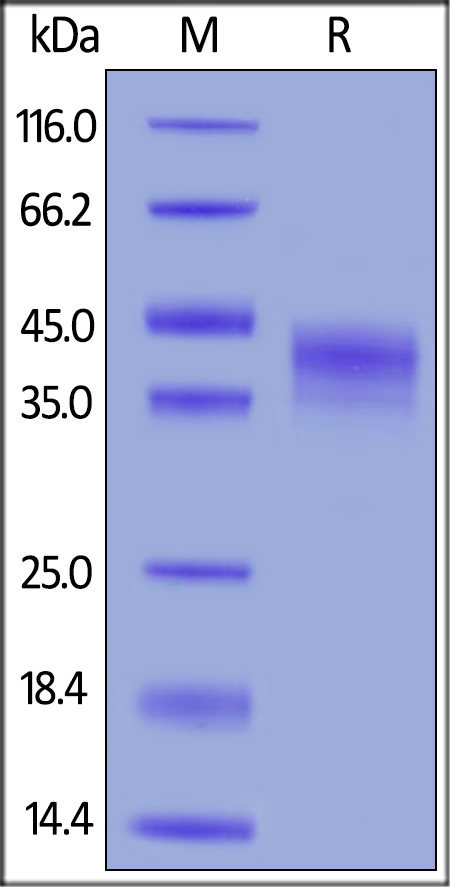 Recombinant human DKK1 protein