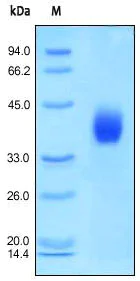 SDS-PAGE - Recombinant human DKK1 protein (AB155623)