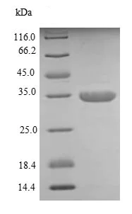 SDS-PAGE - Recombinant Human DKK1 protein (AB235067)