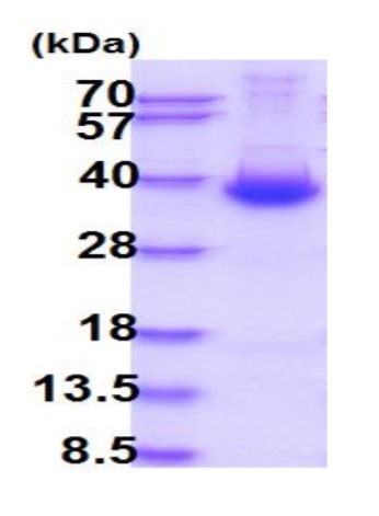 SDS-PAGE - Recombinant Human DKK1 protein (AB87416)