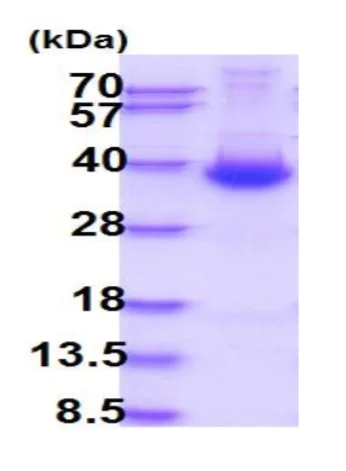 SDS-PAGE - Recombinant Human DKK1 protein (AB87416)