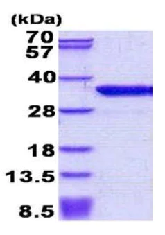SDS-PAGE - Recombinant Human DKK1 protein (denatured) (AB156969)