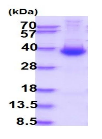 SDS-PAGE - Recombinant Human DKK1 protein (His tag C-Terminus) (AB87416)